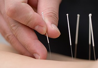 A Look at Medical Acupuncture