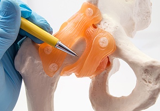 Anterior Hip Replacement: What You Need to Know