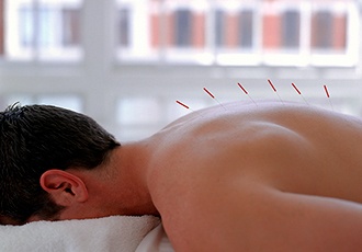 Frequently Asked Questions About Acupuncture Therapy