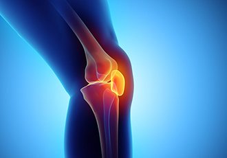 How to Live Well With Osteoarthritis
