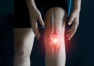 How to Prevent ACL Injury for Athletes, and Why It’s Especially Important for Women