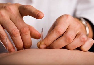 Understanding Medical Acupuncture