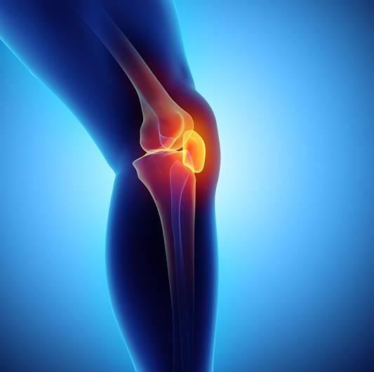 How to Live Well With Osteoarthritis