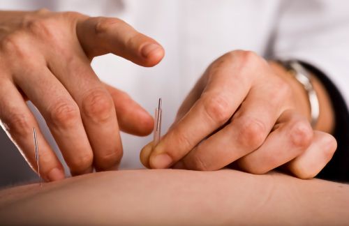 Understanding Medical Acupuncture